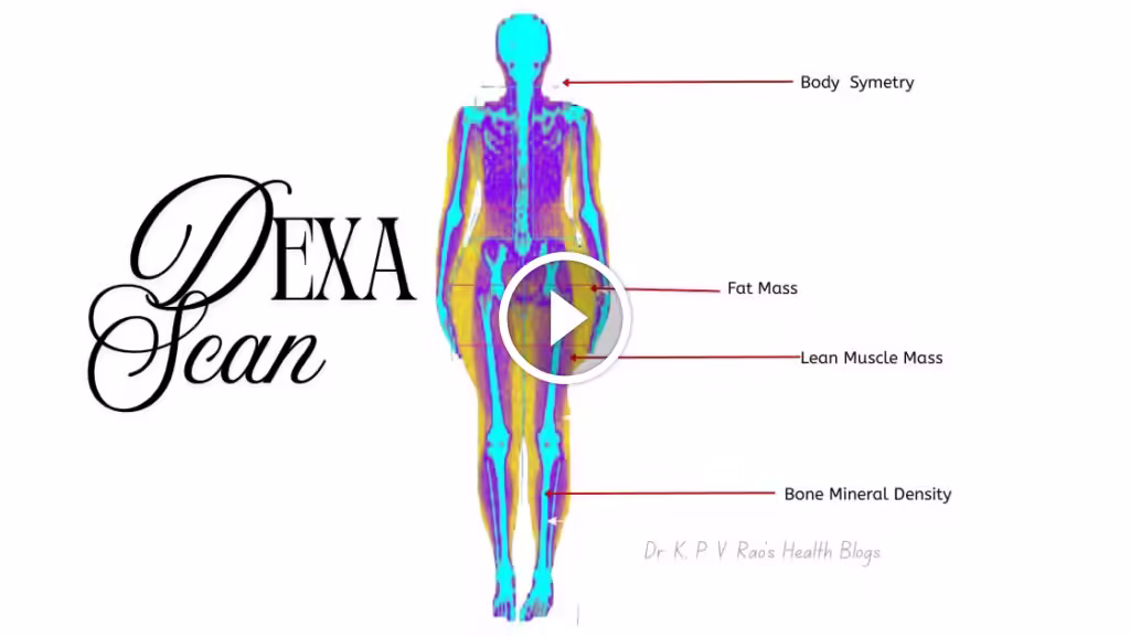 Dexa Scan- What Is It And How Does It Help You