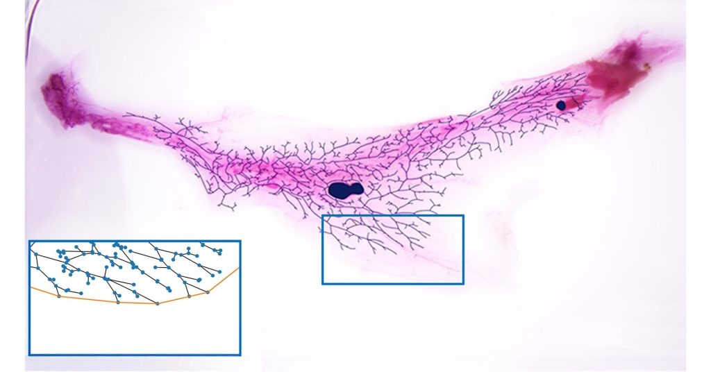 The magnetic math of breast health