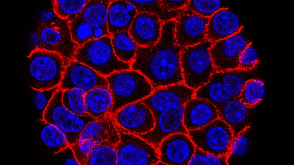 Experimental pill promises new hope for deadly pancreatic cancer