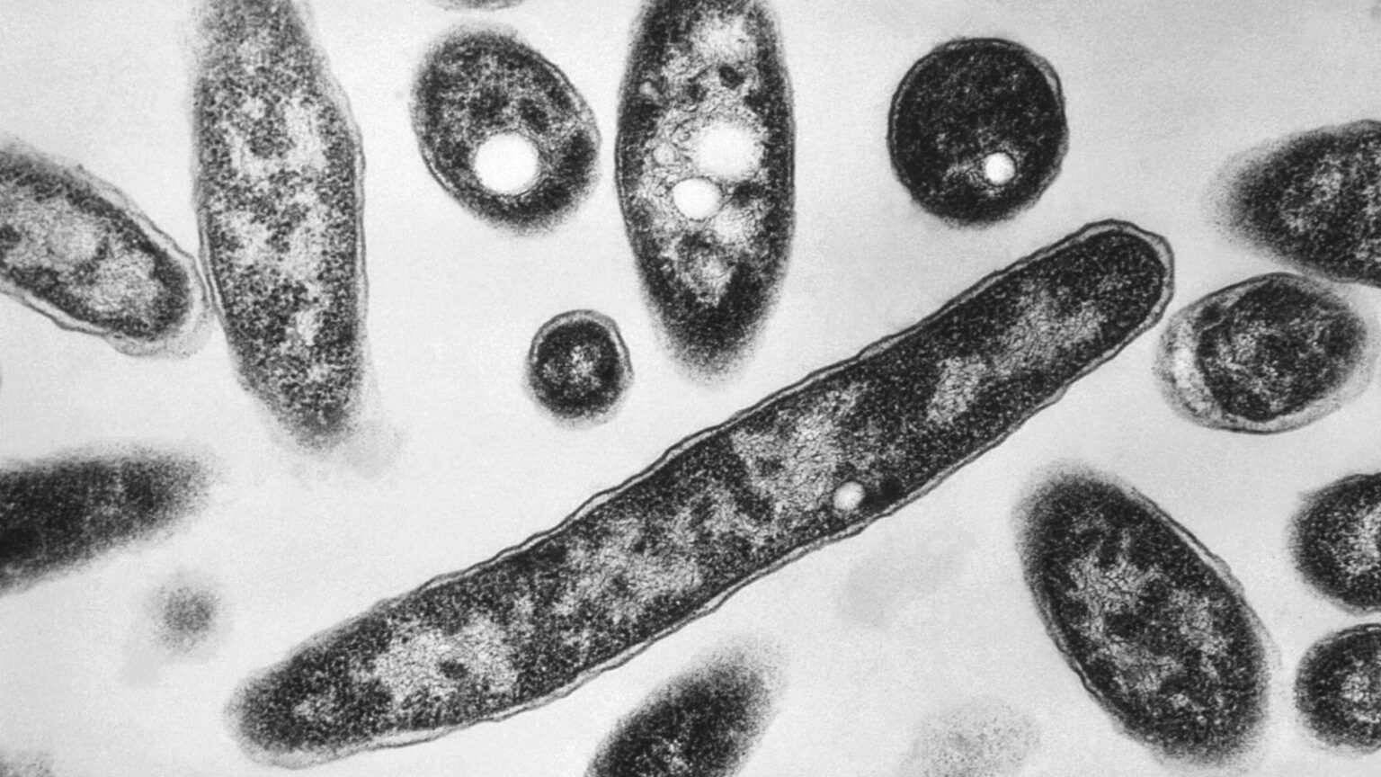 First death reported in Legionnaires’ disease outbreak in New York City