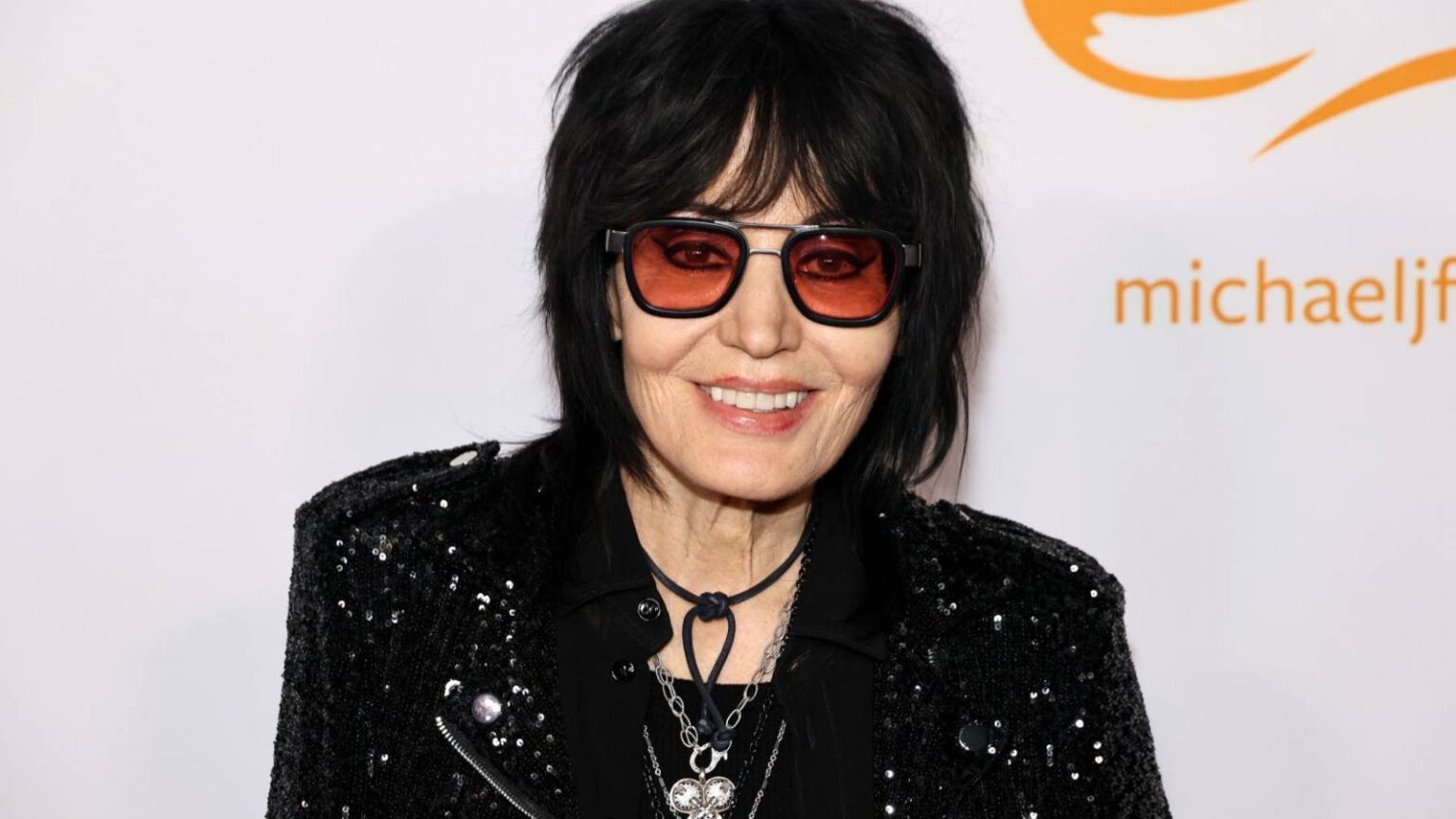 Joan Jett Cancels Upcoming Shows to Recover From Recent Surgery