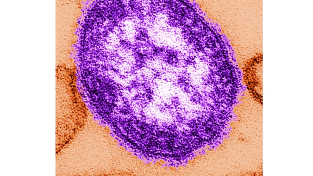 Coroner releases details of infants who died amid growing measles outbreak